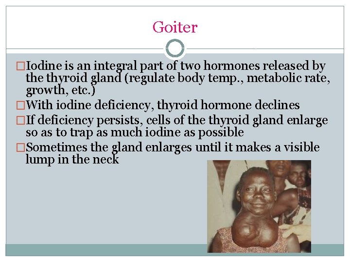 Goiter �Iodine is an integral part of two hormones released by the thyroid gland