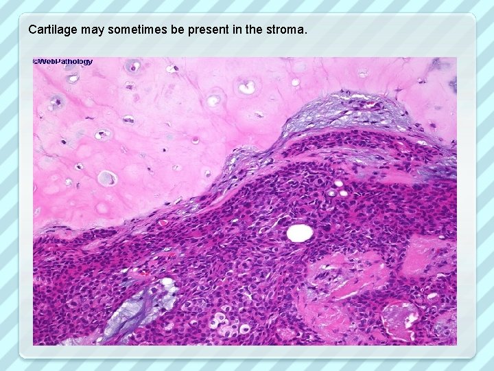 Cartilage may sometimes be present in the stroma. 