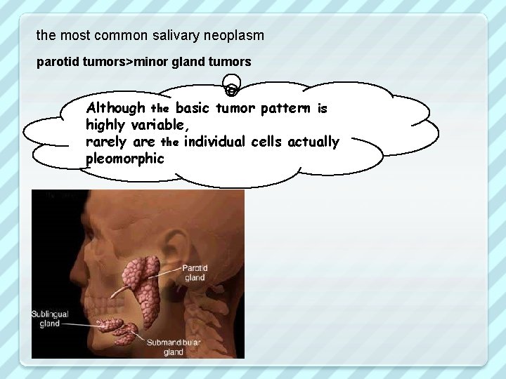 the most common salivary neoplasm parotid tumors>minor gland tumors Although the basic tumor pattern