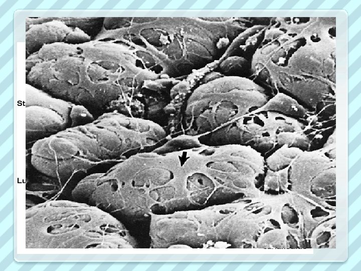 derived from a mixture of ductal and myoepithelial elements 