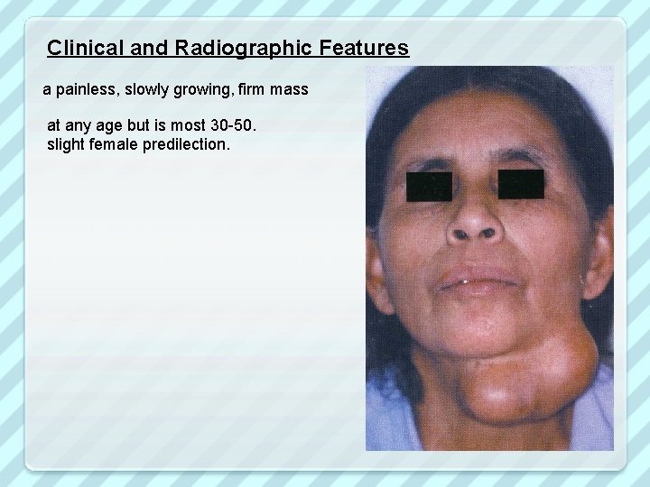 Clinical and Radiographic Features a painless, slowly growing, firm mass at any age but