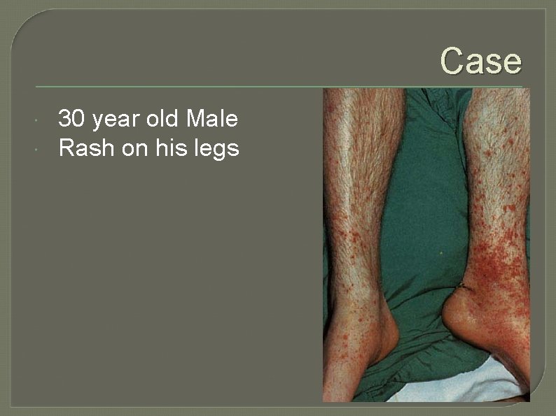Case 30 year old Male Rash on his legs 