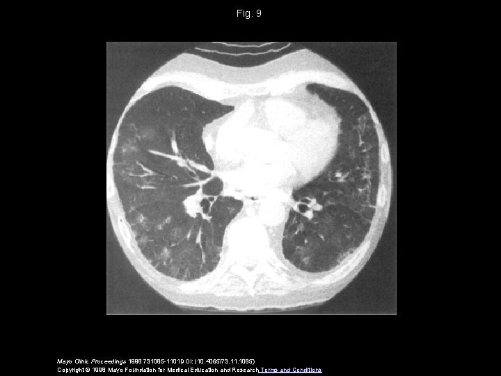 Fig. 9 Mayo Clinic Proceedings 1998 731085 -1101 DOI: (10. 4065/73. 11. 1085) Copyright