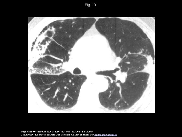 Fig. 10 Mayo Clinic Proceedings 1998 731085 -1101 DOI: (10. 4065/73. 11. 1085) Copyright