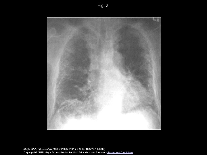 Fig. 2 Mayo Clinic Proceedings 1998 731085 -1101 DOI: (10. 4065/73. 11. 1085) Copyright