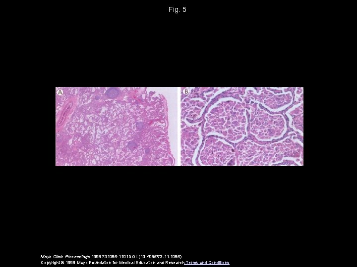 Fig. 5 Mayo Clinic Proceedings 1998 731085 -1101 DOI: (10. 4065/73. 11. 1085) Copyright