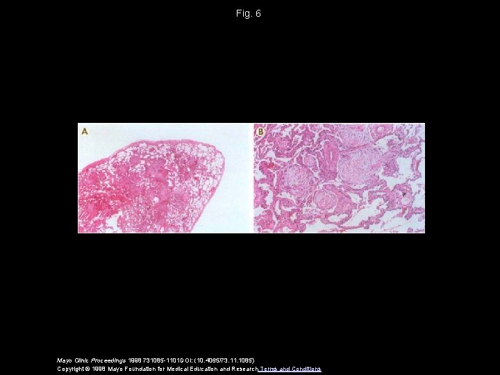 Fig. 6 Mayo Clinic Proceedings 1998 731085 -1101 DOI: (10. 4065/73. 11. 1085) Copyright