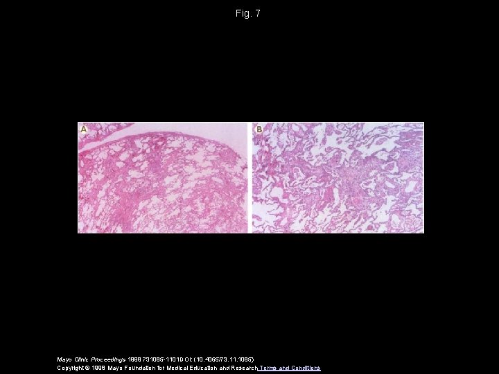 Fig. 7 Mayo Clinic Proceedings 1998 731085 -1101 DOI: (10. 4065/73. 11. 1085) Copyright