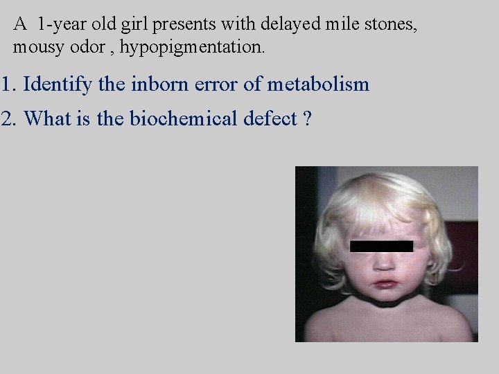 A 1 -year old girl presents with delayed mile stones, mousy odor , hypopigmentation.