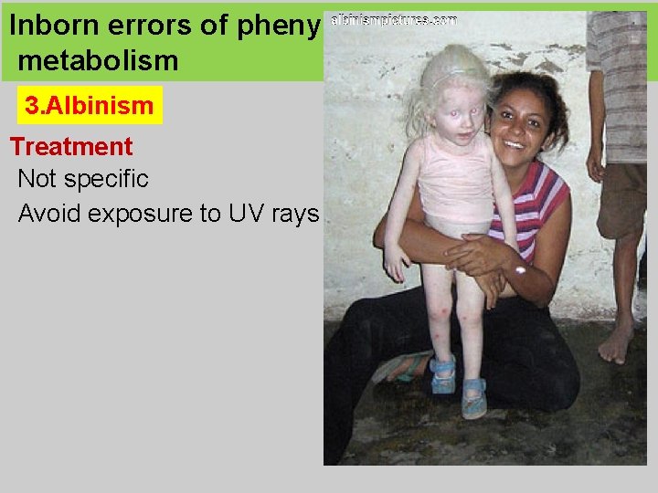 Inborn errors of phenylalanine and tyrosine metabolism 3. Albinism Treatment Not specific Avoid exposure