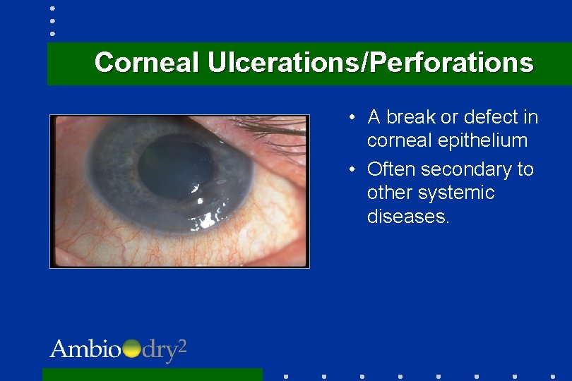 Corneal Ulcerations/Perforations • A break or defect in corneal epithelium • Often secondary to