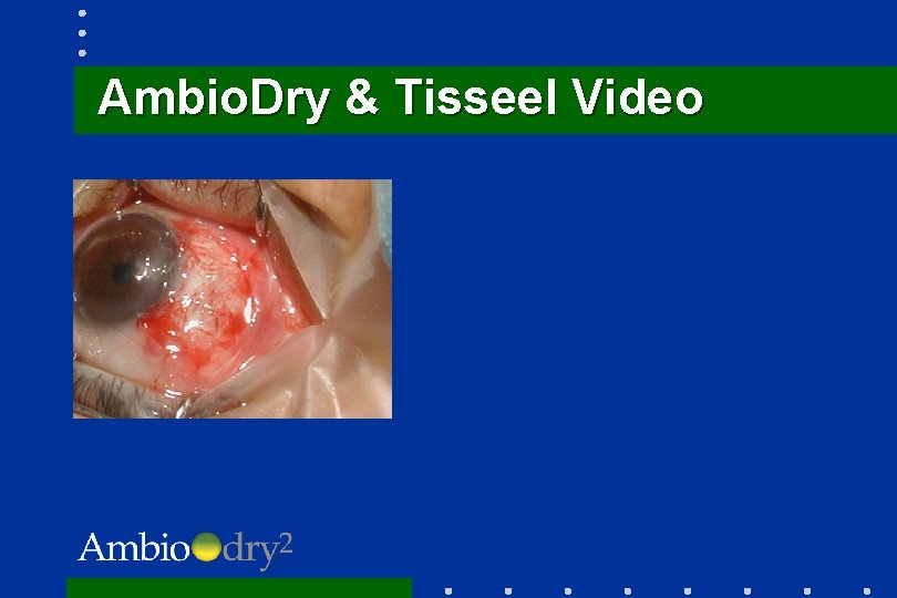 Ambio. Dry & Tisseel Video 