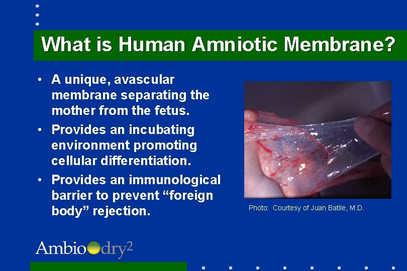 What is Human Amniotic Membrane? • A unique, avascular membrane separating the mother from