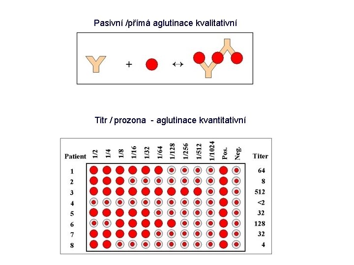 Pasivní /přímá aglutinace kvalitativní Titr / prozona - aglutinace kvantitativní 