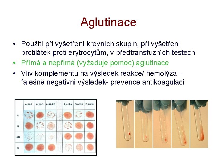 Aglutinace • Použití při vyšetření krevních skupin, při vyšetření protilátek proti erytrocytům, v předtransfuzních