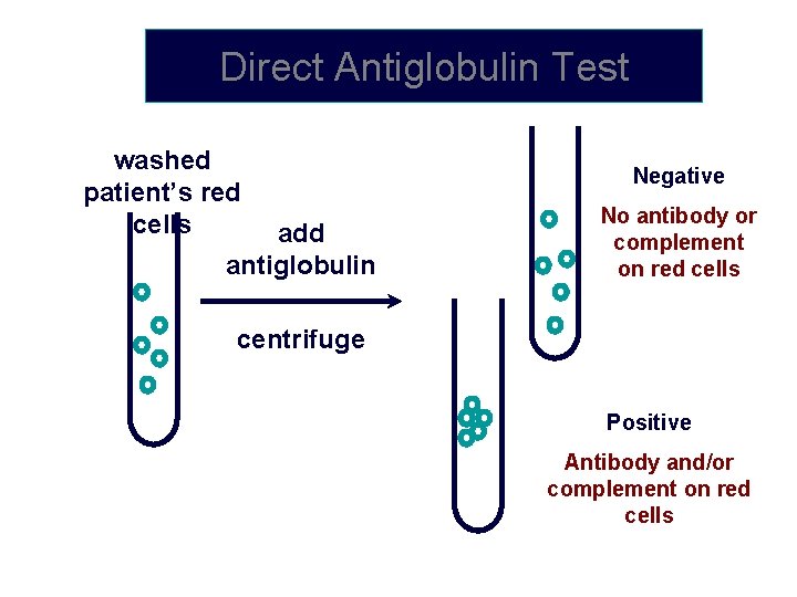 Direct Antiglobulin Test washed patient’s red cells add antiglobulin Negative No antibody or complement