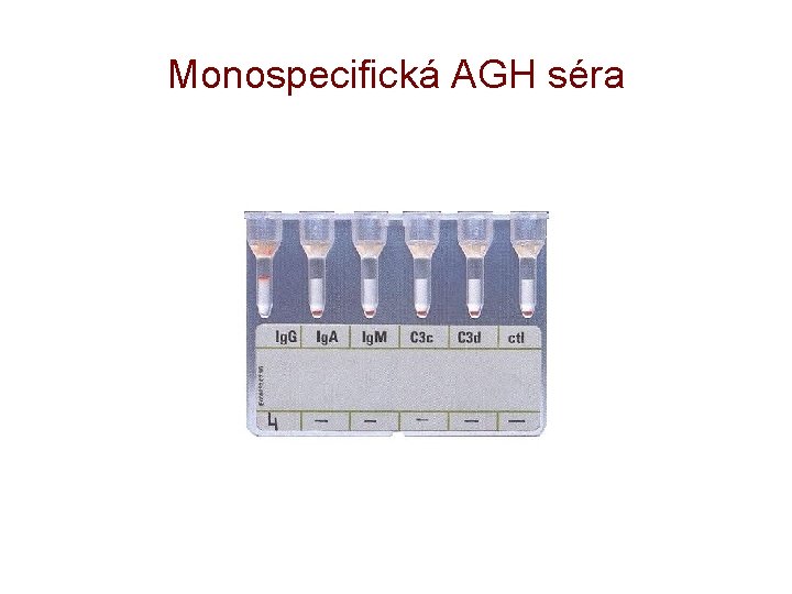 Monospecifická AGH séra 