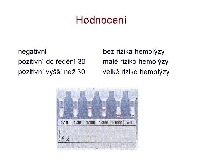 Hodnocení negativní pozitivní do ředění 30 pozitivní vyšší než 30 bez rizika hemolýzy malé