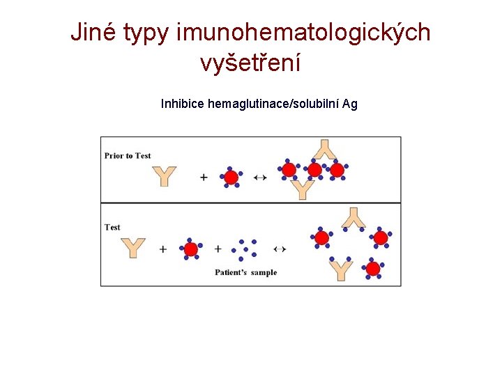 Jiné typy imunohematologických vyšetření Inhibice hemaglutinace/solubilní Ag 