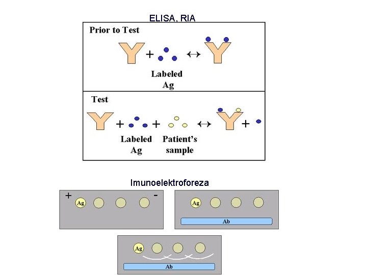 ELISA, RIA Imunoelektroforeza 