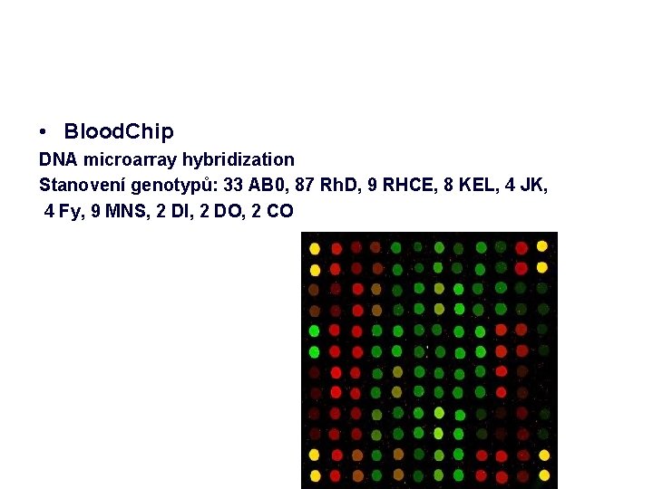  • Blood. Chip DNA microarray hybridization Stanovení genotypů: 33 AB 0, 87 Rh.