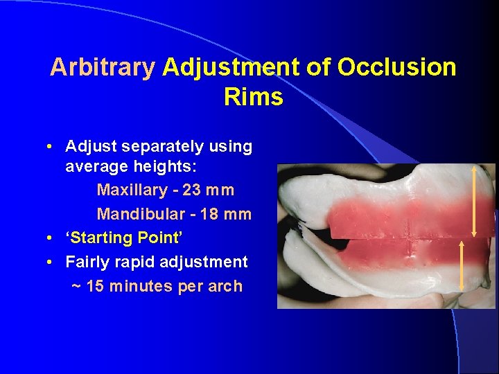 Arbitrary Adjustment of Occlusion Rims • Adjust separately using average heights: Maxillary - 23