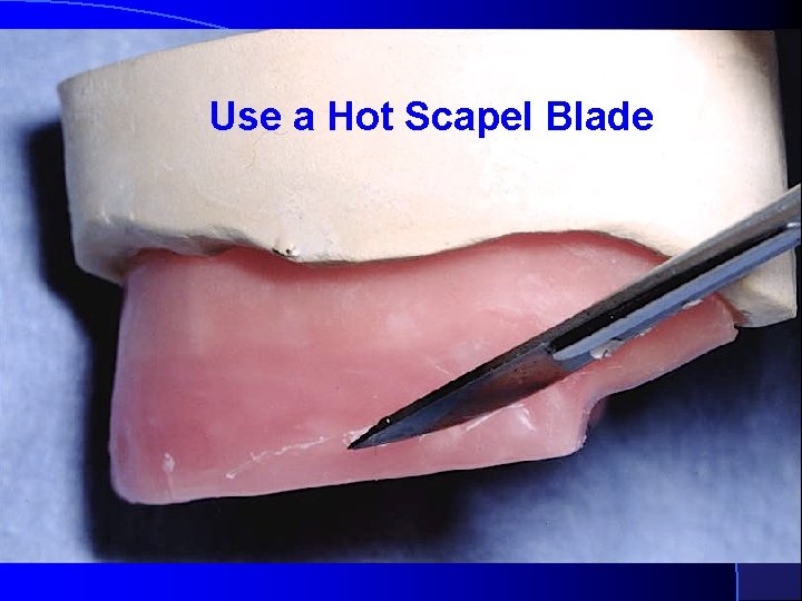 Use a Hot Scapel Blade 