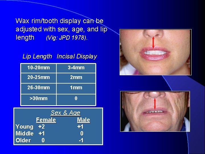 Wax rim/tooth display can be adjusted with sex, age, and lip length (Vig: JPD