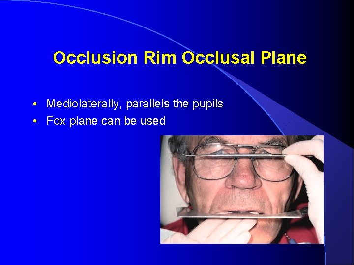 Occlusion Rim Occlusal Plane • Mediolaterally, parallels the pupils • Fox plane can be