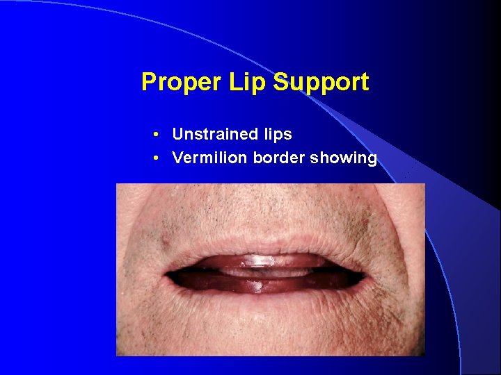 Proper Lip Support • Unstrained lips • Vermilion border showing 