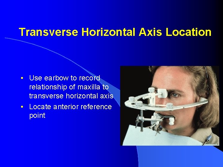 Transverse Horizontal Axis Location • Use earbow to record relationship of maxilla to transverse