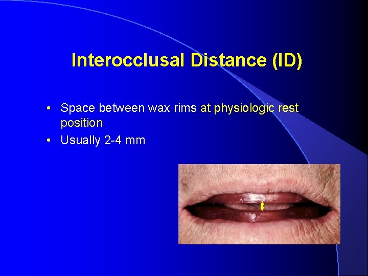 Interocclusal Distance (ID) • Space between wax rims at physiologic rest position • Usually