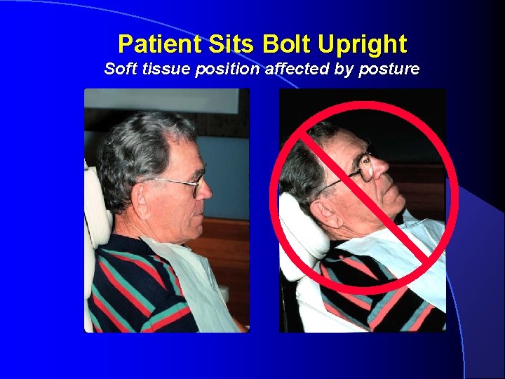 Patient Sits Bolt Upright Soft tissue position affected by posture 