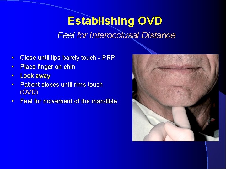 Establishing OVD Feel for Interocclusal Distance • • Close until lips barely touch -