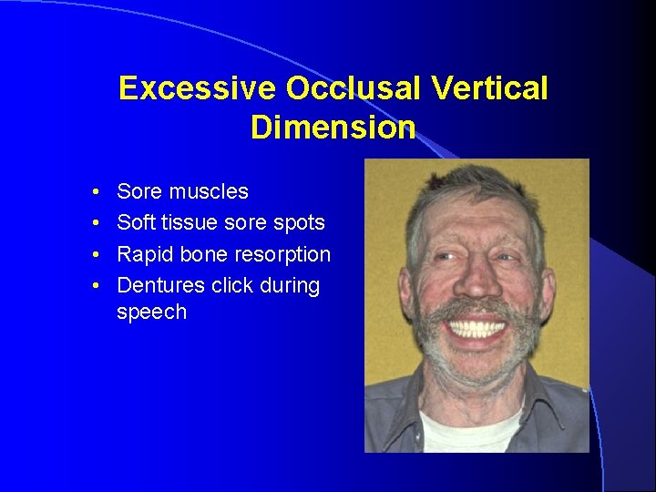 Excessive Occlusal Vertical Dimension • • Sore muscles Soft tissue sore spots Rapid bone