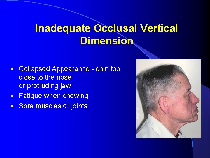 Inadequate Occlusal Vertical Dimension • Collapsed Appearance - chin too close to the nose