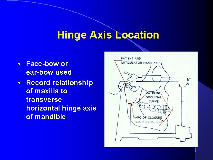Hinge Axis Location • Face-bow or ear-bow used • Record relationship of maxilla to