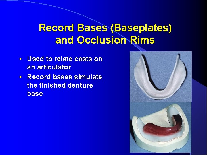 Record Bases (Baseplates) and Occlusion Rims • Used to relate casts on an articulator Record Bases (Baseplates) and Occlusion Rims • Used to relate casts on an articulator