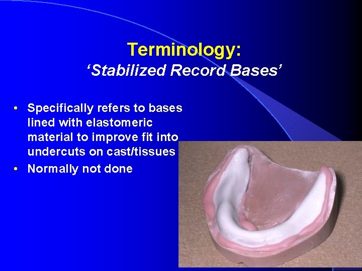 Terminology: ‘Stabilized Record Bases’ • Specifically refers to bases lined with elastomeric material to