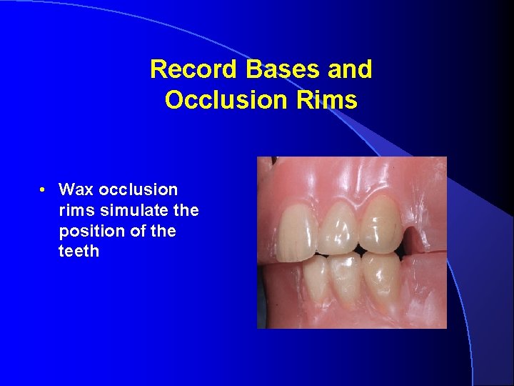 Record Bases and Occlusion Rims • Wax occlusion rims simulate the position of the