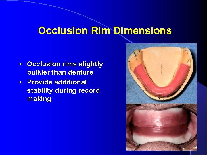 Occlusion Rim Dimensions • Occlusion rims slightly bulkier than denture • Provide additional stability Occlusion Rim Dimensions • Occlusion rims slightly bulkier than denture • Provide additional stability