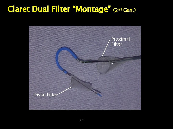 Claret Dual Filter “Montage” (2 nd Gen. ) Proximal Filter Distal Filter 20 