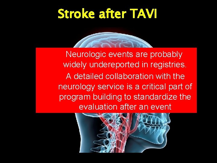 Stroke after TAVI Neurologic events are probably widely undereported in registries. A detailed collaboration