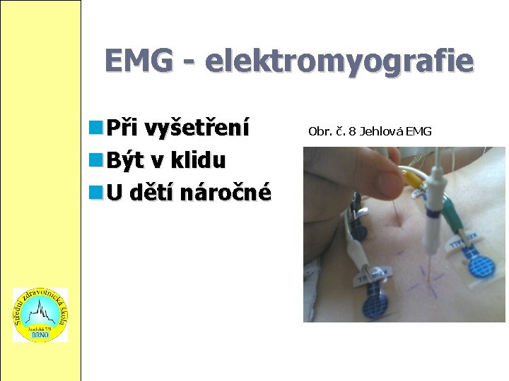 EMG - elektromyografie Při vyšetření Být v klidu U dětí náročné Obr. č. 8