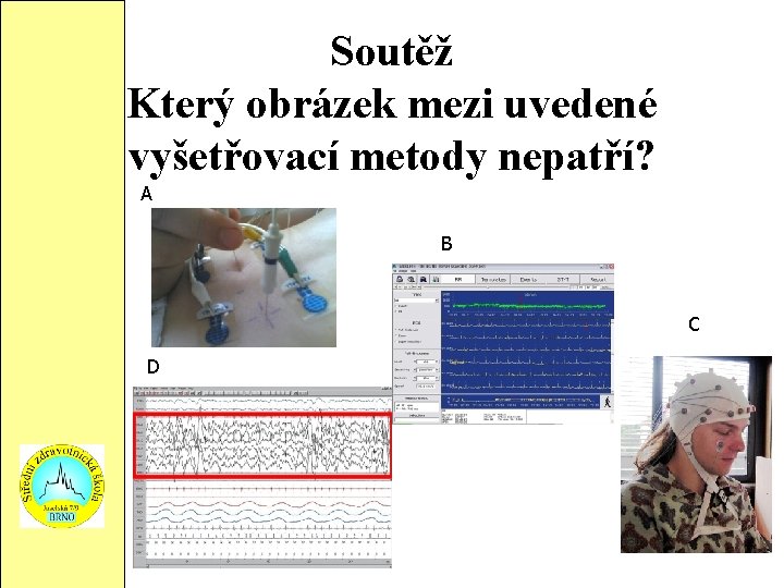 Soutěž Který obrázek mezi uvedené vyšetřovací metody nepatří? A B C D 