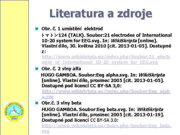 Literatura a zdroje Obr. č. 1 umístění elektrod トマトン 124 (TALK). Soubor: 21 electrodes