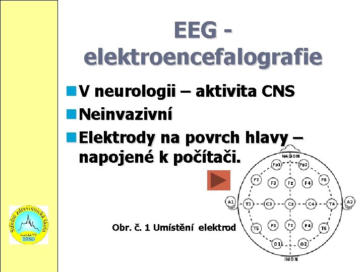 EEG elektroencefalografie V neurologii – aktivita CNS Neinvazivní Elektrody na povrch hlavy – napojené