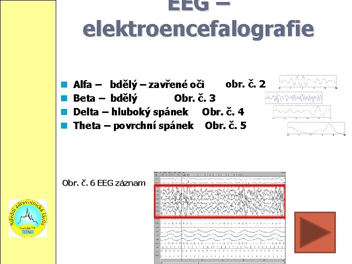 EEG – elektroencefalografie obr. č. 2 Alfa – bdělý – zavřené oči Beta –