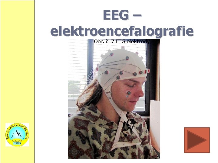 EEG – elektroencefalografie Obr. č. 7 EEG elektrody 