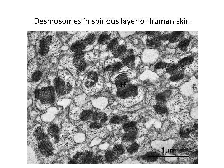 Desmosomes in spinous layer of human skin 